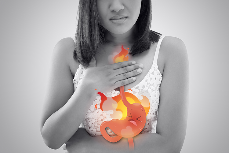 5 Important Health and Diet Tips to Manage Acidity